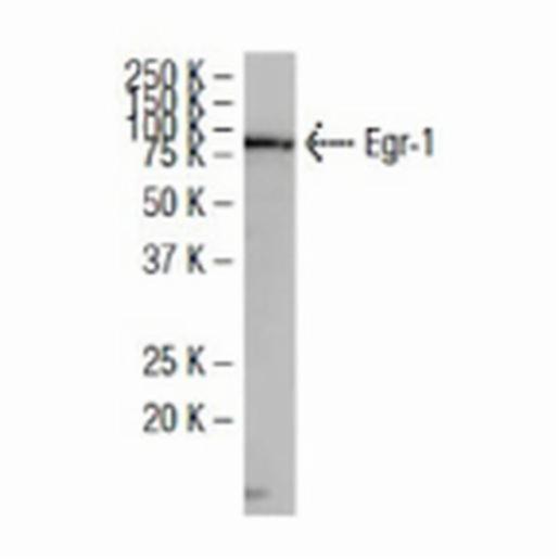 Santa Cruz EGR-1 ANTIBODY (S-25), 100 µg/ml SANTSC-101033